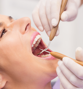 Smile Makeover
